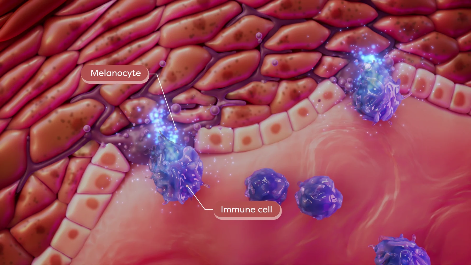 Purple immune cells alongside melanocytes in a pink skin cross-section