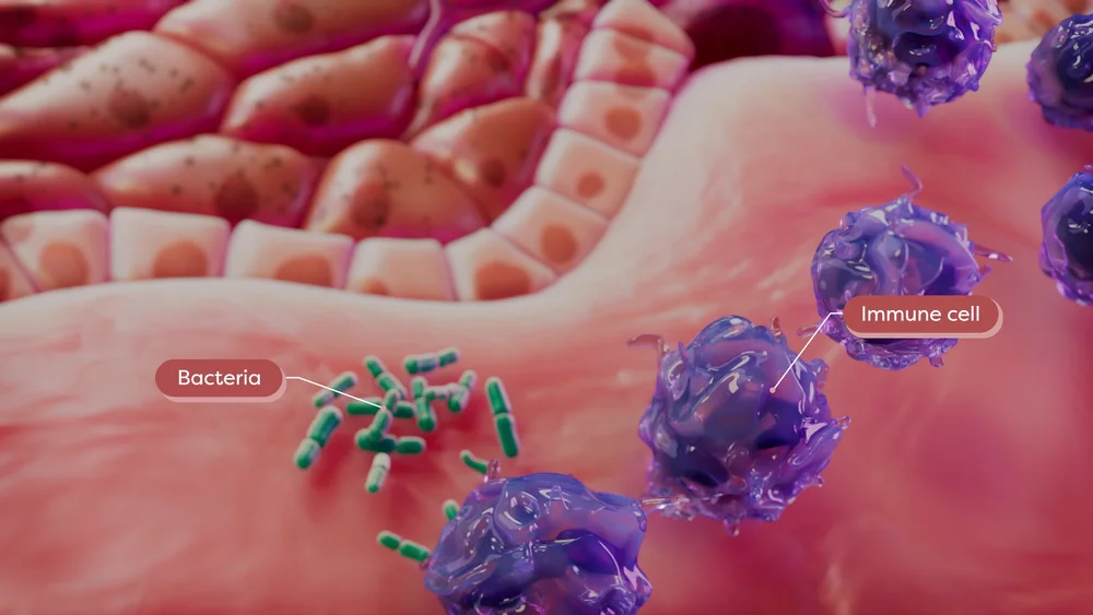 Purple immune cells and green bacteria within a detailed pink microscopic skin environment