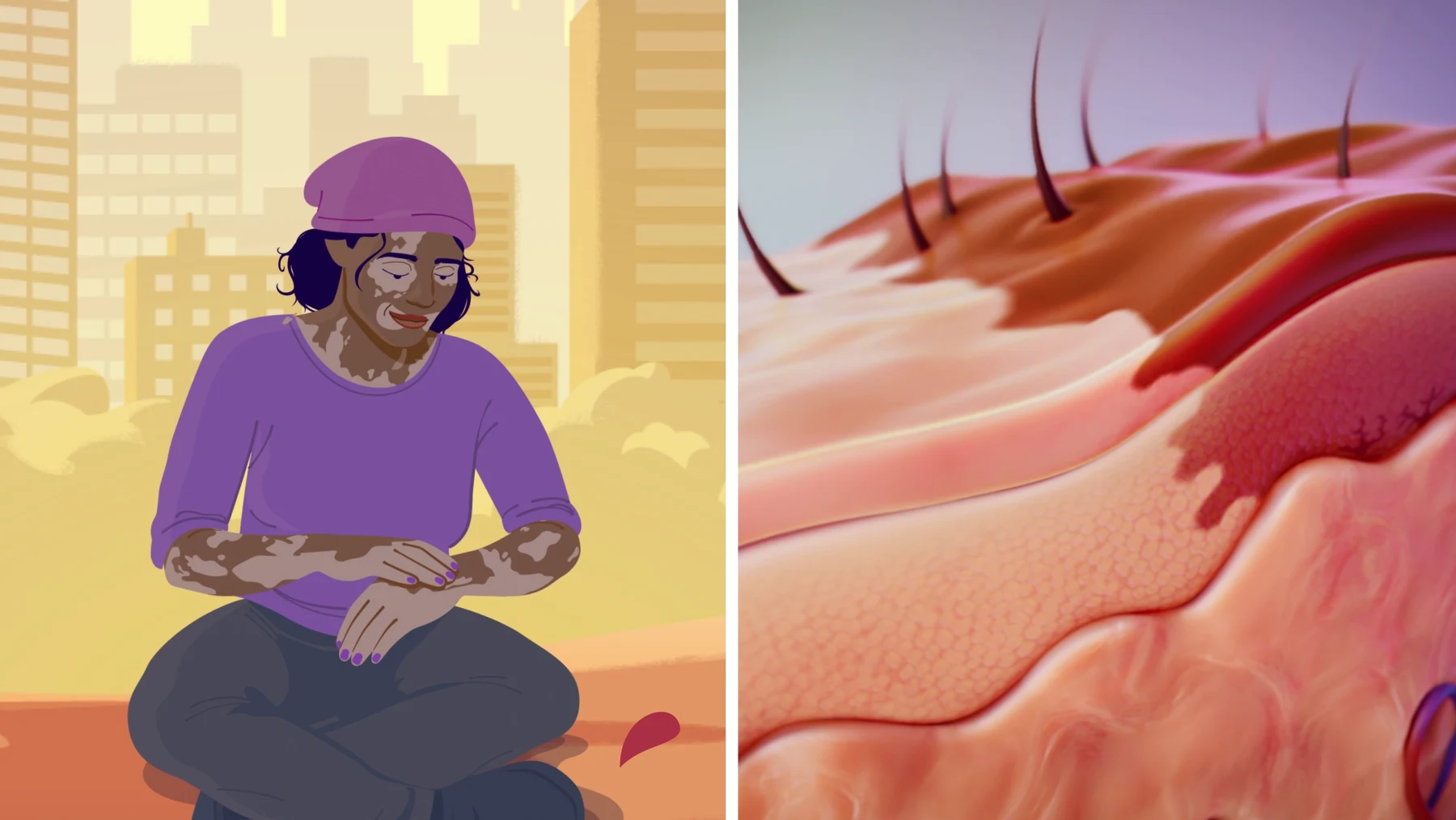 An illustrated patient beside a three-dimensional skin surface